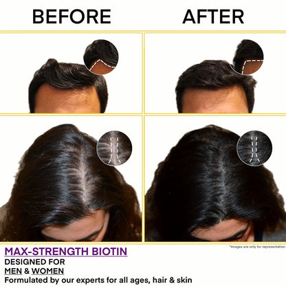 BioClinical Biotin Tablets for Hair Growth - Biotin 10000mcg for Hair,Skin & Nails - Supplement for Men & Women Hair Growth - Vegan Vitamin B 7 -PureVe Forte Medicine -120 Veg Tablets