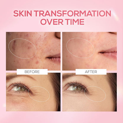 Before and after comparison of skin transformation on a pink background
