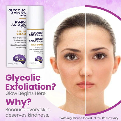 Get Nectar Happiness 6% Glycolic & 2% Kojic Acid Serum Cream Helps Reduce Pigmentation, Acne Scars, Dark, Age Spots, Blemishes & Uneven Skin Tone. Promotes a Brighter, Smoother-Looking Complexion 50ml