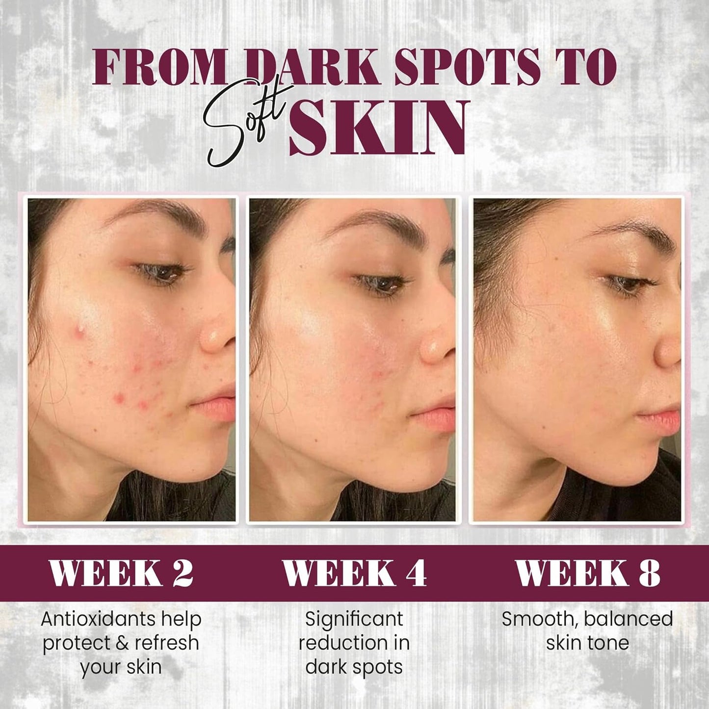 Before and after skin improvement over weeks 2, 4, and 8 with text indicating product benefits.