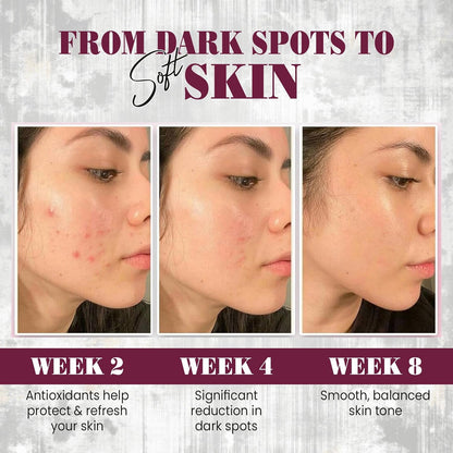 Before and after skin improvement over weeks 2, 4, and 8 with text indicating product benefits.