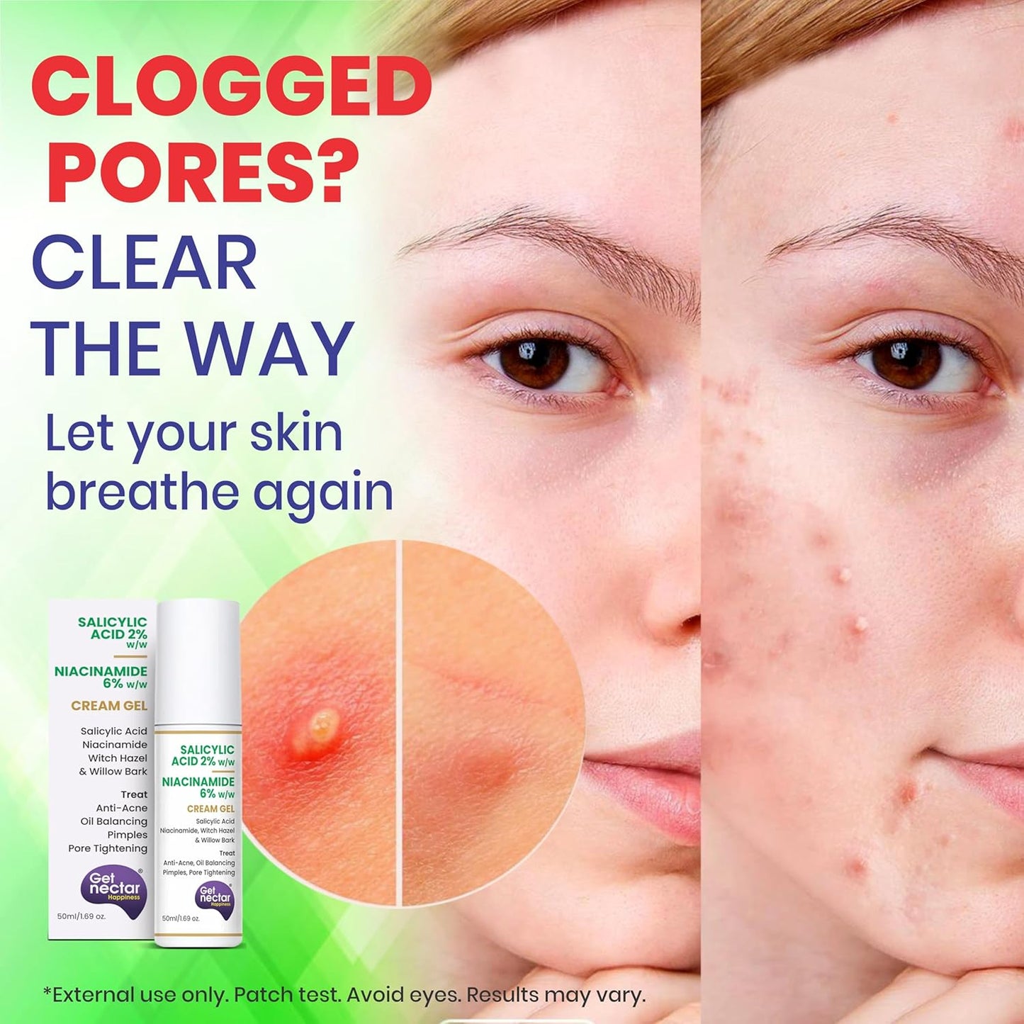 Advertisement for skincare products with a split-screen showing clogged pores and clear skin.