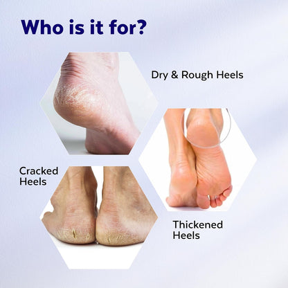 TrueWise 20% Urea Crack Heel Repair Foot Cream Roll On 50ml Foot Cream For Dry And Cracked Feet With 2% Lactic Acid, Olive Oil & Vitamin E | Help Heel Repair and Moisturise Cracked Heels