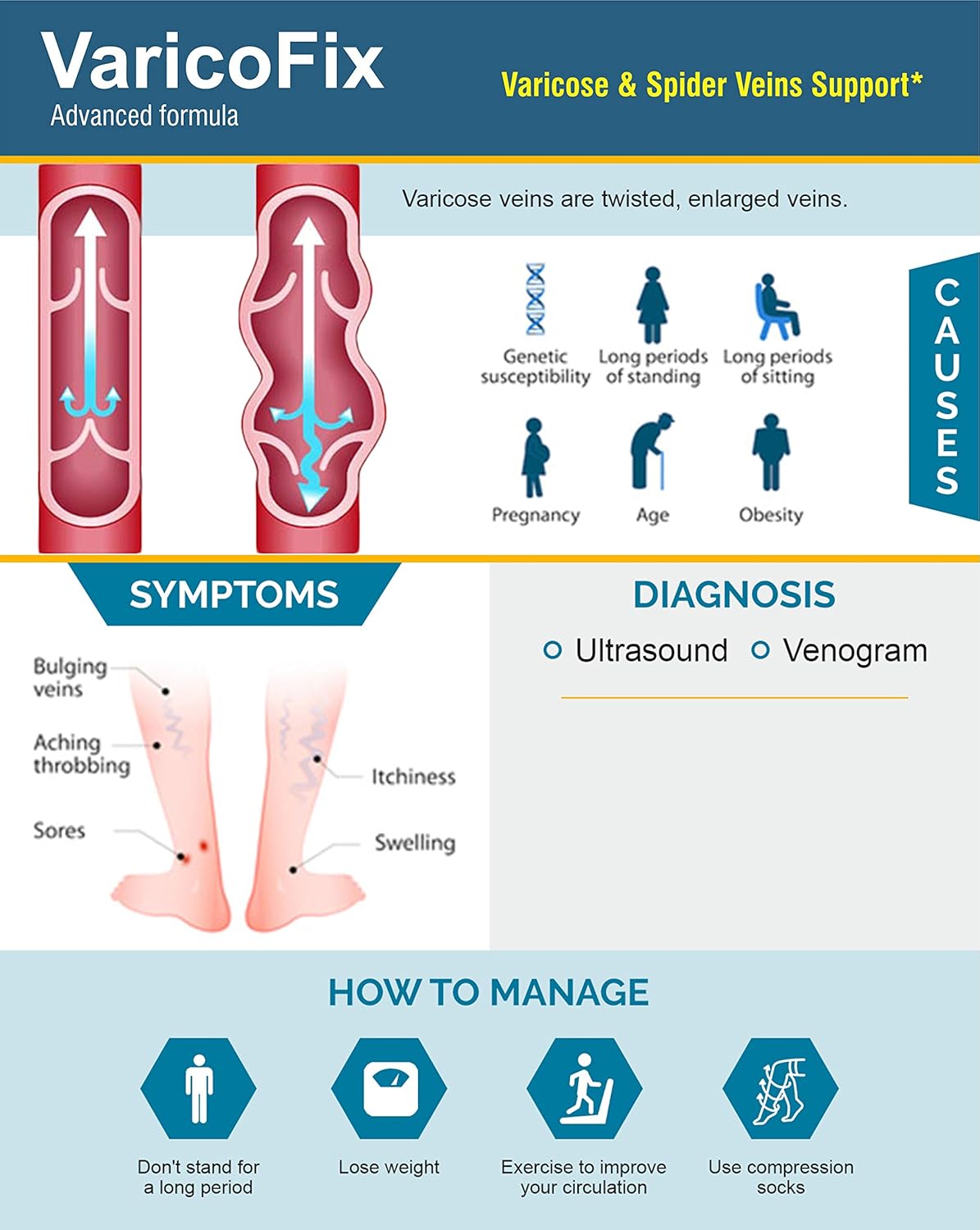 Infographic about VaricoFix for varicose and spider veins support, including symptoms, causes, diagnosis, and management.