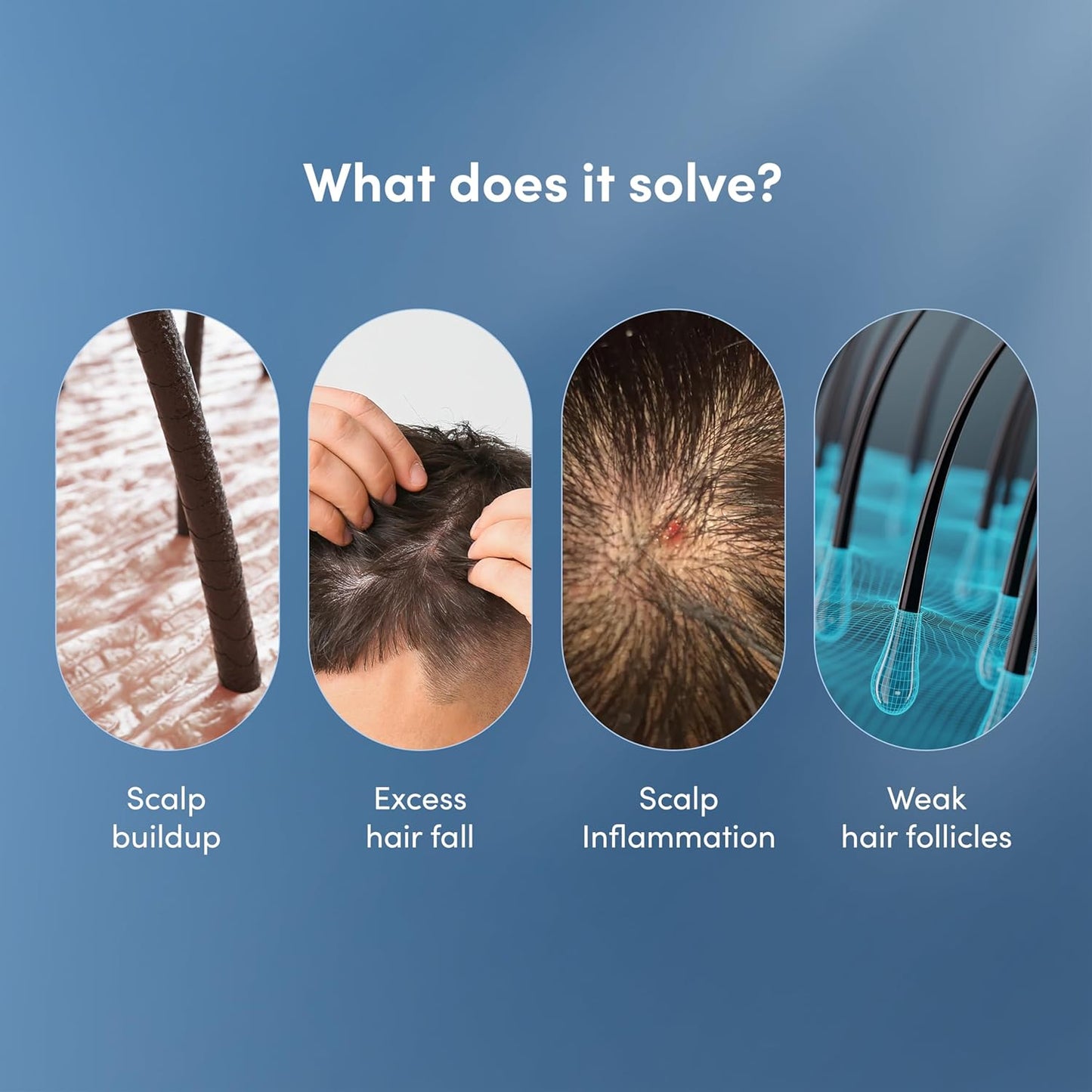 Man Matters DHT Blocking Anti Hair Fall Shampoo 200ml | Paraben & Sulphate Free | With 1% Saw Palmetto, Biotin, Caffeine & Argan Oil | No Side Effects