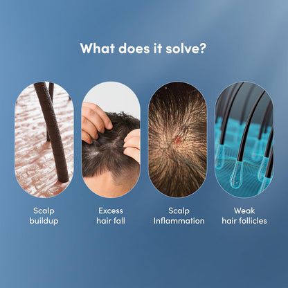 Man Matters DHT Blocking Anti Hair Fall Shampoo 200ml | Paraben & Sulphate Free | With 1% Saw Palmetto, Biotin, Caffeine & Argan Oil | No Side Effects