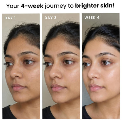 Foxtale Lightweight Brightening Face Moisturiser with Vitamin C & Niacinamide |Brightens & Evens Skin Tone, Fades Dark Spots & Deeply Hydrates | For Normal to Dry Skin | For Men & Women | 50 g