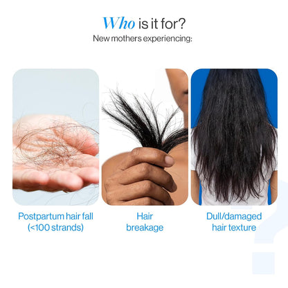 Be Bodywise Biotin Hair Supplement Gummies for Postpartum Hair fall | Breastfeeding Safe | Reduces Hairfall, Strengthens Hair & Improves Density | Zinc, Folic Acid & Multivitamins | No Added Refined Sugar, 30 Day Pack