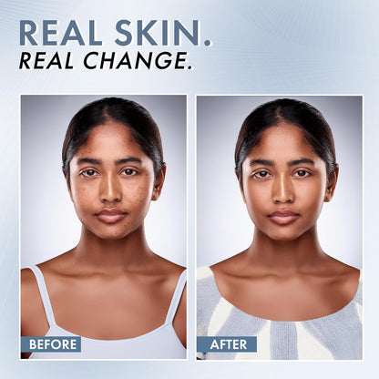 Before and after comparison of a woman's face with text 'Real Skin. Real Change.'