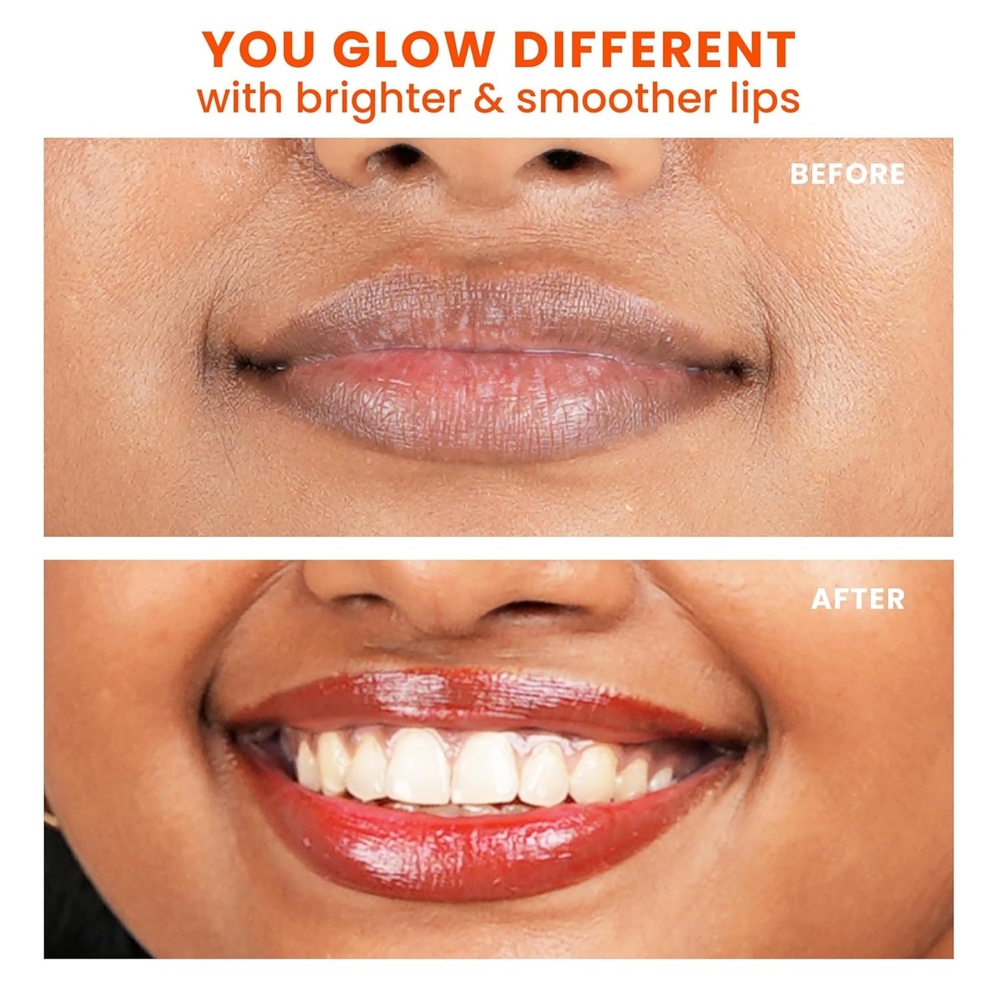 Foxtale SPF 30 Brightening Lip Balm for Dark Lips with Peptides & Vitamin C | Brightens Pigmented Lips | Hydrates Lip | SPF Lip Balm - Ruby Glaze 12gm