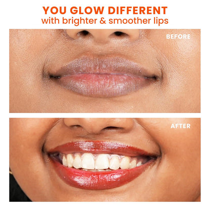 Foxtale SPF 30 Brightening Lip Balm for Dark Lips with Peptides & Vitamin C | Brightens Pigmented Lips | Hydrates Lip | SPF Lip Balm - Ruby Glaze 12gm