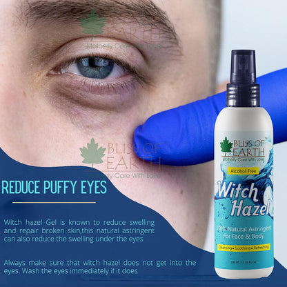 Bliss of Earth Witch Hazel Toner For Face, Acne & Oily Skin, Natural Pore Minimizer, Alcohol Free Facial Astringent, 100ml