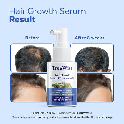 TrueWise hair growth serum bottle with 'Before' and 'After' hair growth results on a blue background