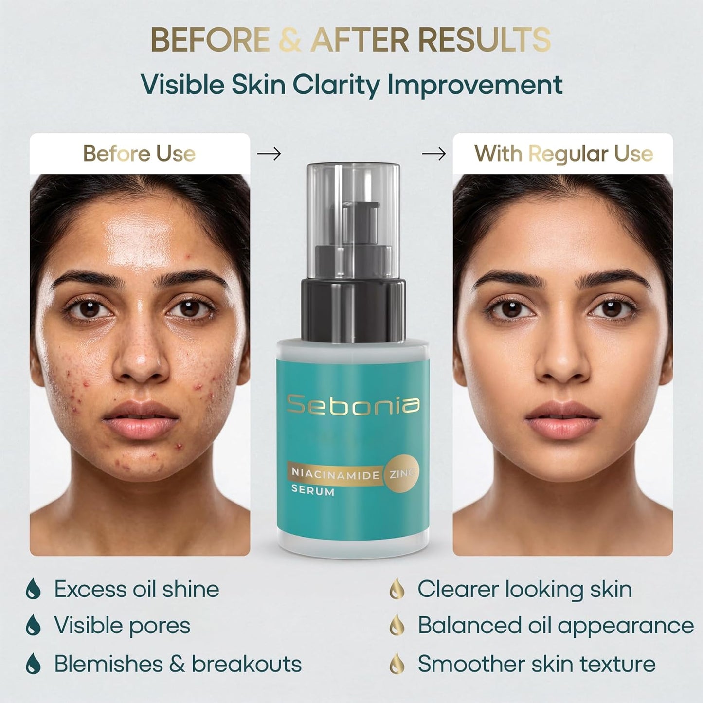 Sebonia Niacinamide Zinc Serum Pack of 1 (20ml)