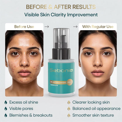 Sebonia Niacinamide Zinc Serum Pack of 1 (20ml)