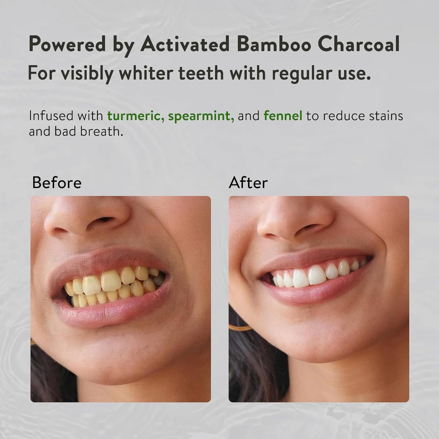 Ayouthveda Ayurvedic Charcoal White Toothpaste | Activated Bamboo Charcoal & Turmeric | Advanced Deep Cleaning | Natural Whitening | Anti-Bacterial Gum Protection & Fresh Breath | 100g (Pack of 1)