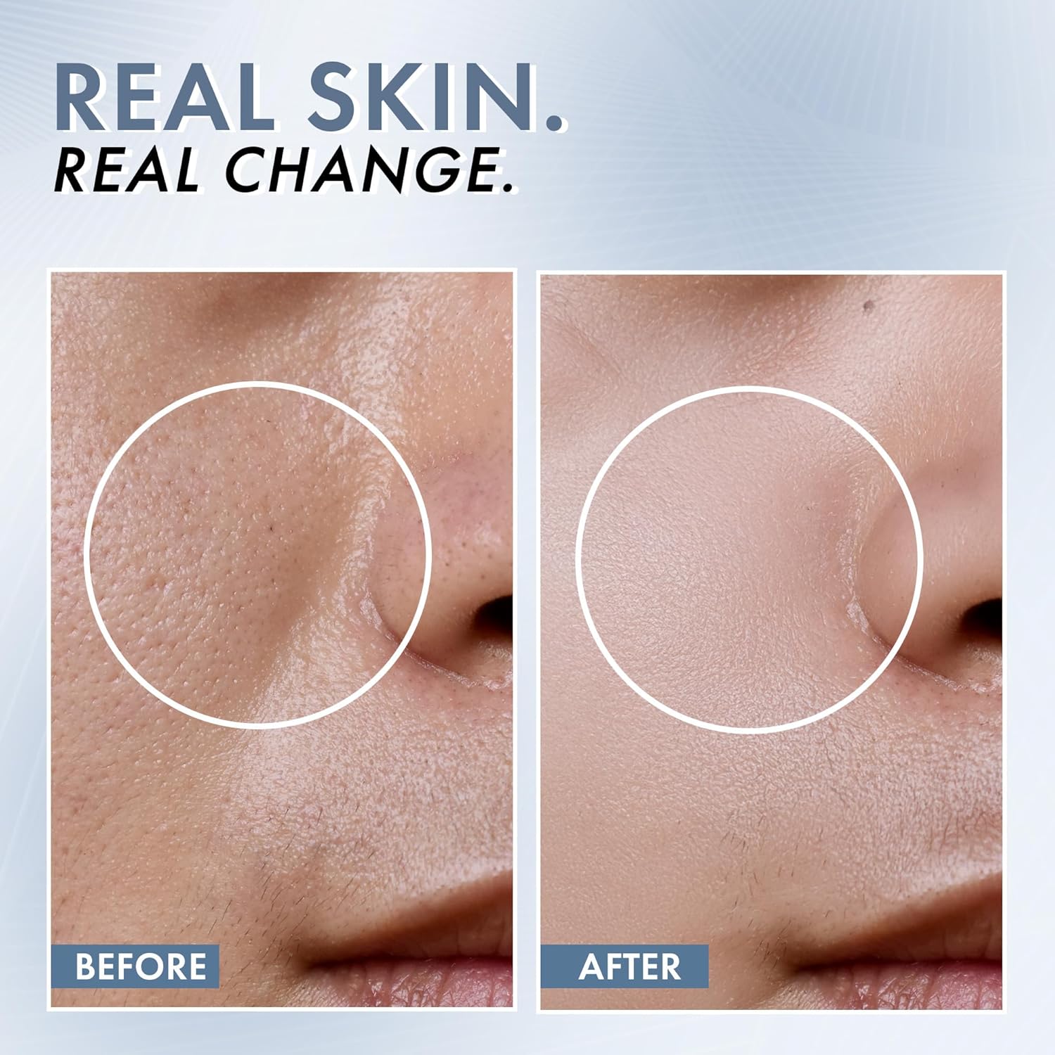 Before and after comparison of skin texture on a person's face with 'Real Skin. Real Change.' text.