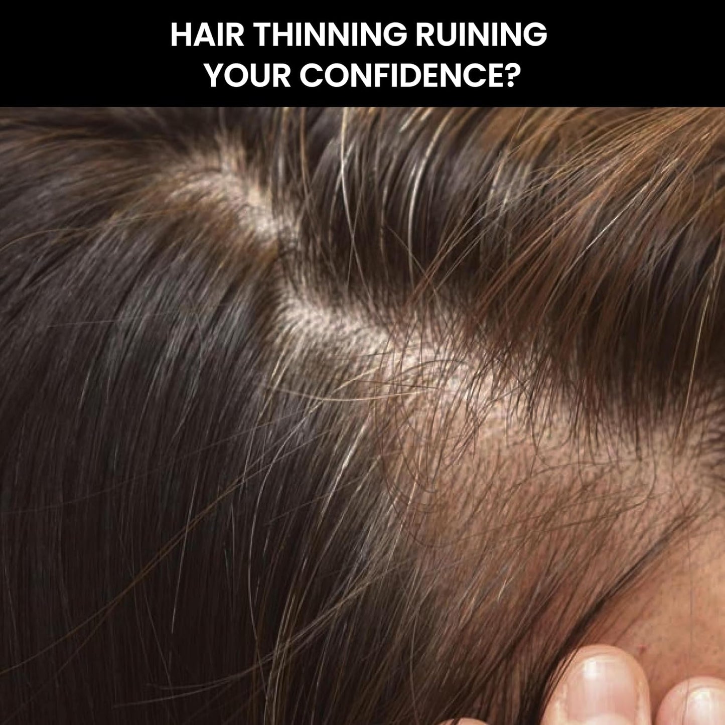 Close-up of hair thinning with text overlay 'Hair thinning ruining your confidence?'
