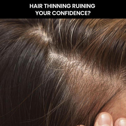 Close-up of hair thinning with text overlay 'Hair thinning ruining your confidence?'