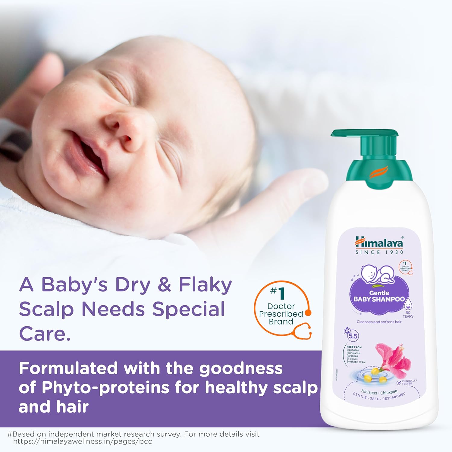 Baby with dry and flaky scalp next to a bottle of Himalaya Baby Shampoo on a white background
