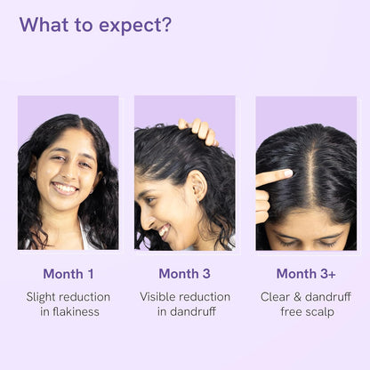 Be bodywise Anti Dandruff Scalp Serum 50ml | Fights Dandruff, Reduces flaky & itchy scalp | With Ichthyol Pale, Zinc Pyrithione, & Tea Tree Oil | Paraben & Sulphate free