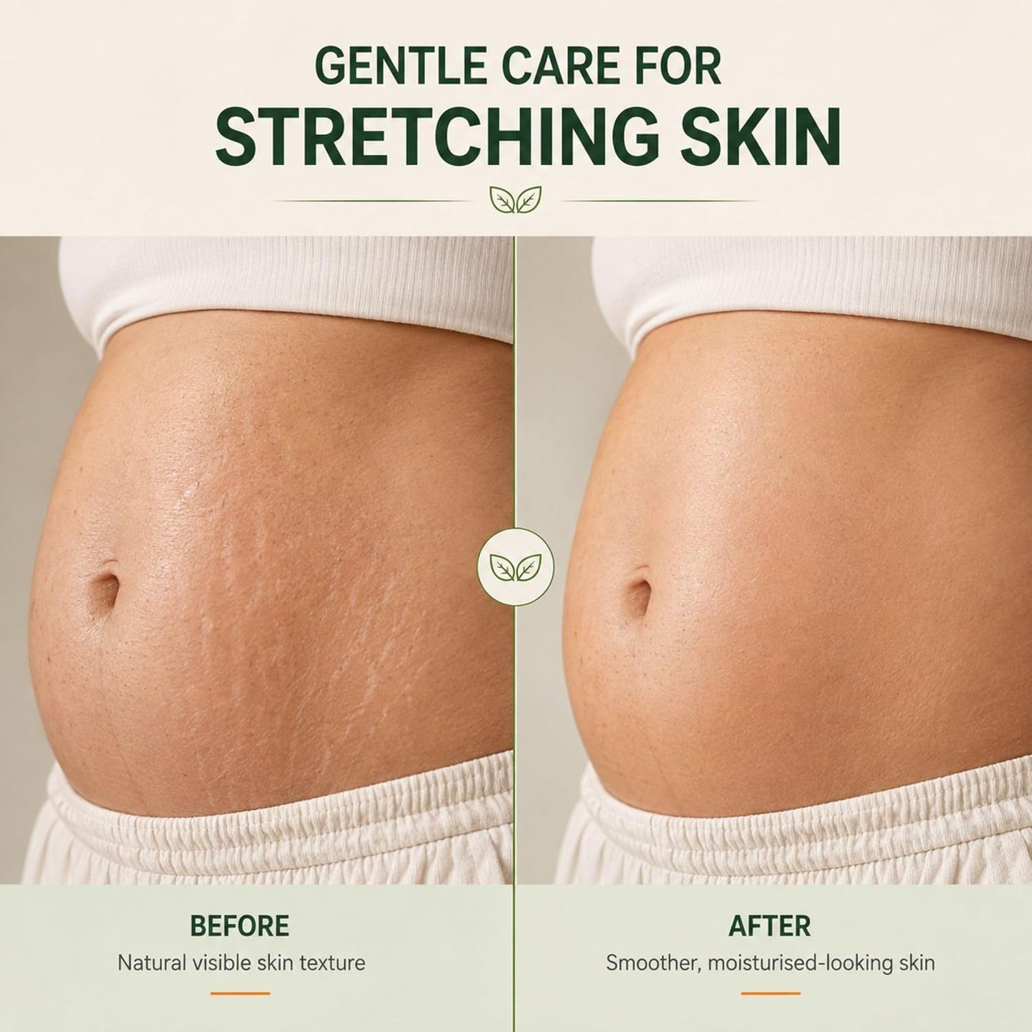 Pregnacream Stretch Mark Cream for Pregnancy & Post Pregnancy, 100g