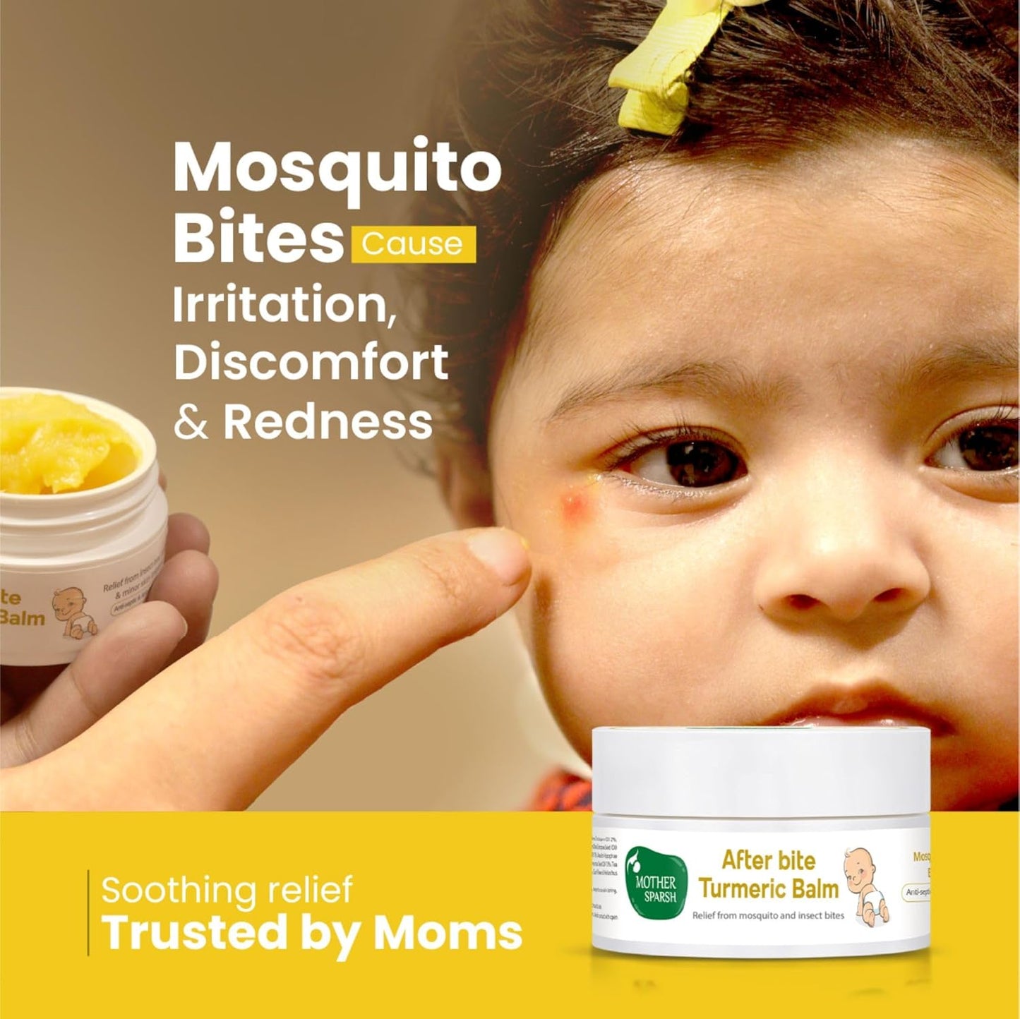 Mother Sparsh After Bite Turmeric Balm for Rashes And Mosquito Bites, 100% Ayurvedic, Gentle Skin Roll-On Formula, 25gm