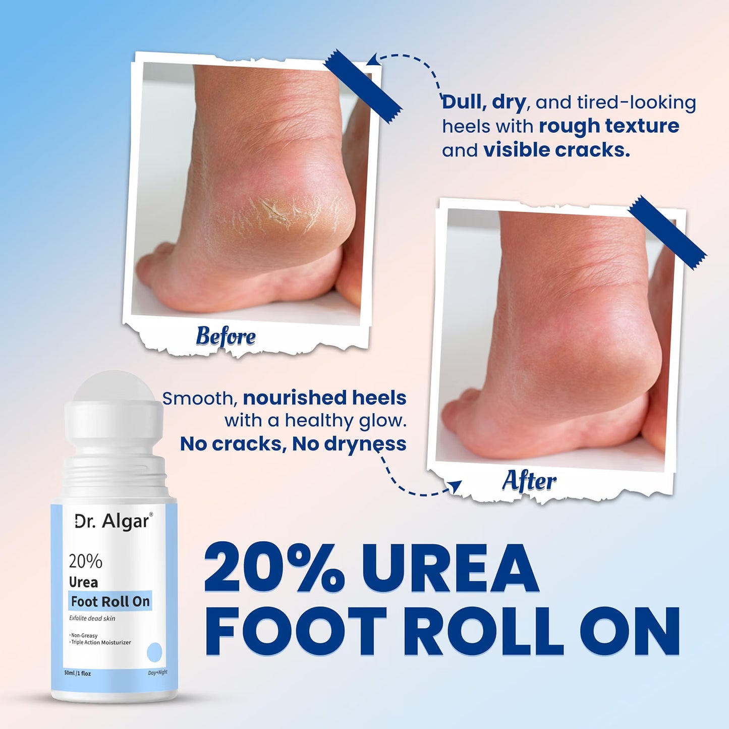 DR.ALGAR 20% Urea Foot Cream Roll On 50ml | 2% Lactic Acid, Olive Oil & Vitamin E | Non-Greasy Triple Action Moisturizer | Best Foot Cream for Cracked Heels | Foot Roll On for Dry & Cracked Feet
