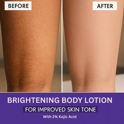 BAKE 2% Kojic Acid Brightening Body Lotion (200 ml) with Niacinamide & SPF 30 PA+++ for Pigmentation & Tan Removal | For Dark Spots & Sun Protection | De-Tan Body Lotion | Tanned & Pigmented Skin | For Women & Men