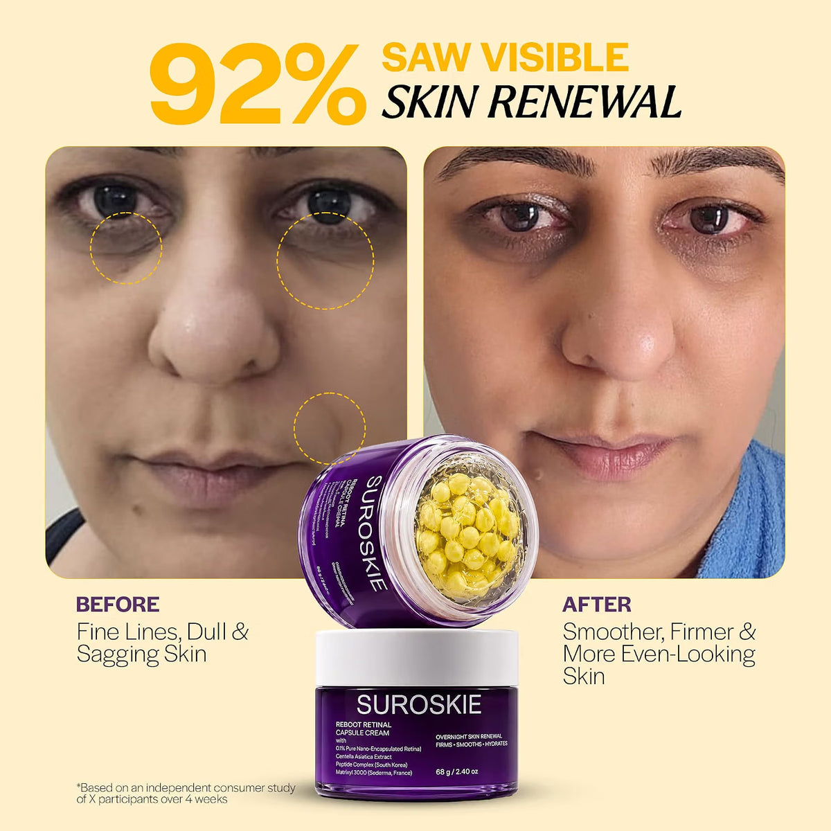 Suroskie Reboot Retinal Capsule Cream with Retinal & Peptide Complex | Overnight Night Cream for Fine Lines, Firming & Hydration | 4D Hyaluronic Acid, Centella & Ceramides | All Skin Types | 68g