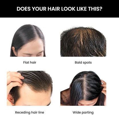 Hair health assessment chart showing flat hair, bald spots, receding hairline, and wide parting issues.
