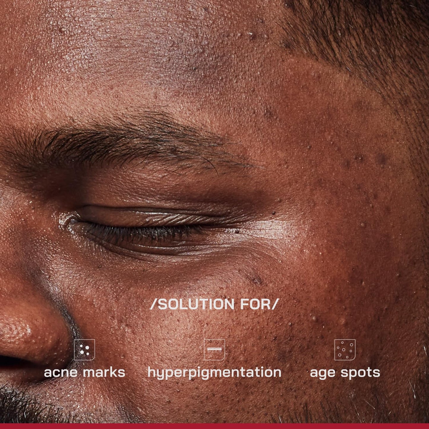 Proven Honest Derma /PHD/ 2% Alpha Arbutin Depigmentation Serum | Alpha Arbutin for Pigmentation & Dark Spot | Pigmentation serum for Women & Men | Tyrobright™, Niacinamide | Tan removal | Fragrance-Free | 30ml