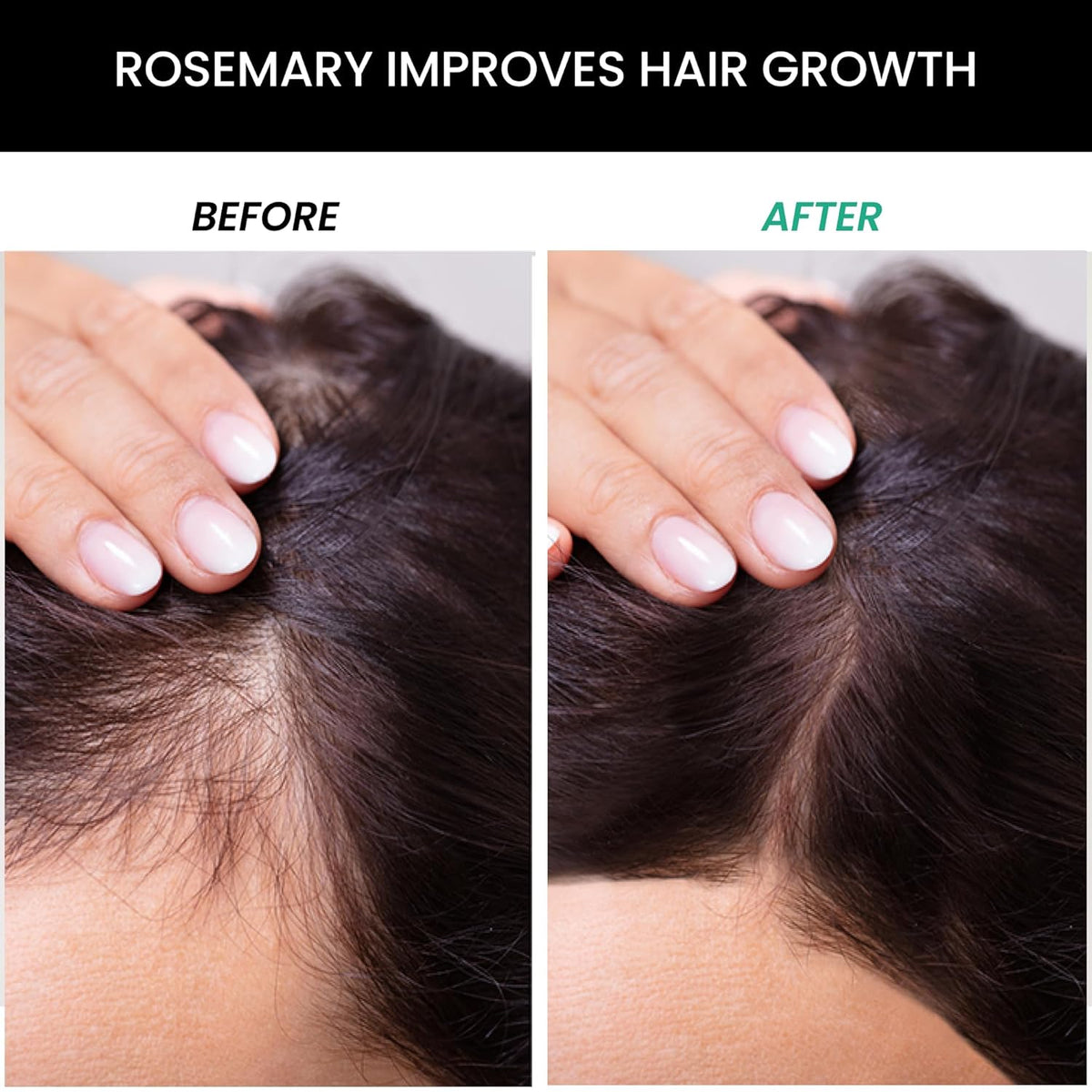 Before and after comparison of hair growth with rosemary, showing a hand touching hair on scalp.