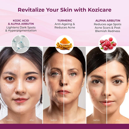 Kozicare Kojic Acid Cream | Turmeric Cream | Haldi Cream| Glutathione Cream | Detan Cream | Moisturizer for Dry Skin | Face Cream for Summer Daily Use | Face Cream for Women & Men - 15 Gm