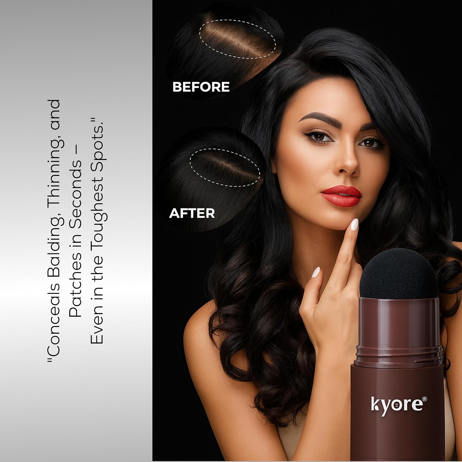 Woman with 'Before' and 'After' hairline comparison holding a kyore product.