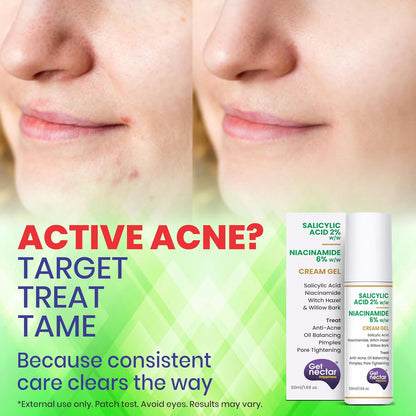 Product advertisement for Gel nectar cream gel with before and after acne treatment on a green background.