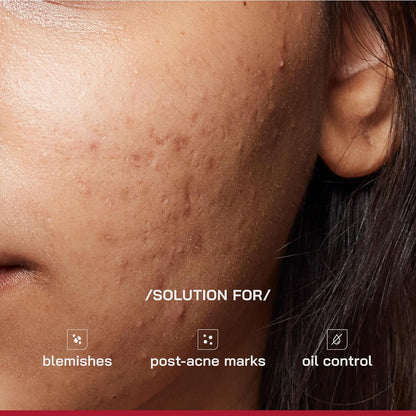 /PHD/ 10% Niacinamide Spot Correcting Serum | Niacinamide for Oily Skin, Acne Scars & Enlarged Pores | Face Serum for Acne-Prone Skin with 2% NAG | Fades Marks, Controls Oil I 10ml