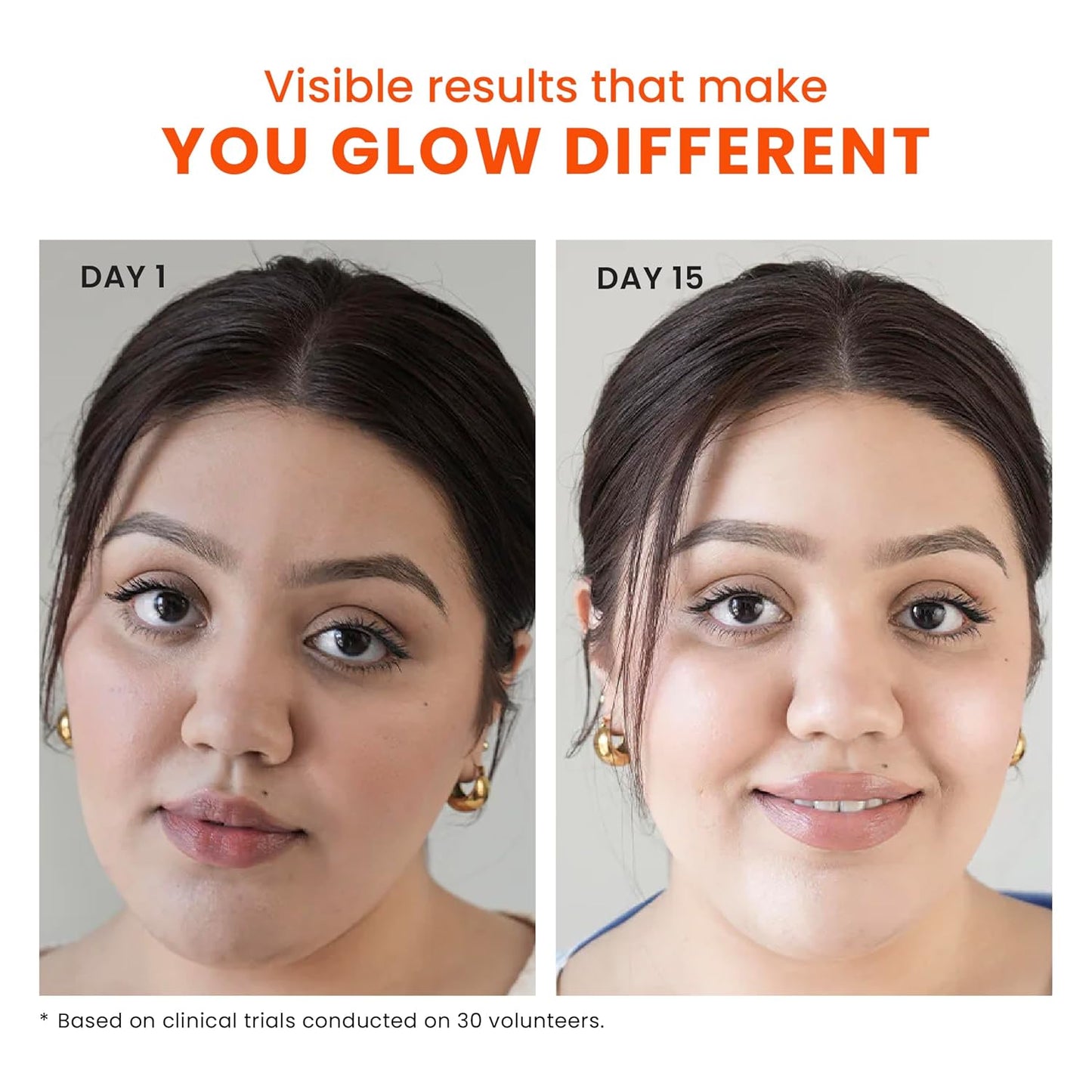 Foxtale SPF 50 Vitamin C Glow Sunscreen with PA++++ & Niacinamide | Lightweight | Fast Absorbing | UVA and UVB Filters | Prevents Tanning | No White Cast | Non-Greasy | For Men & Women | All Skin Types | 50 Ml