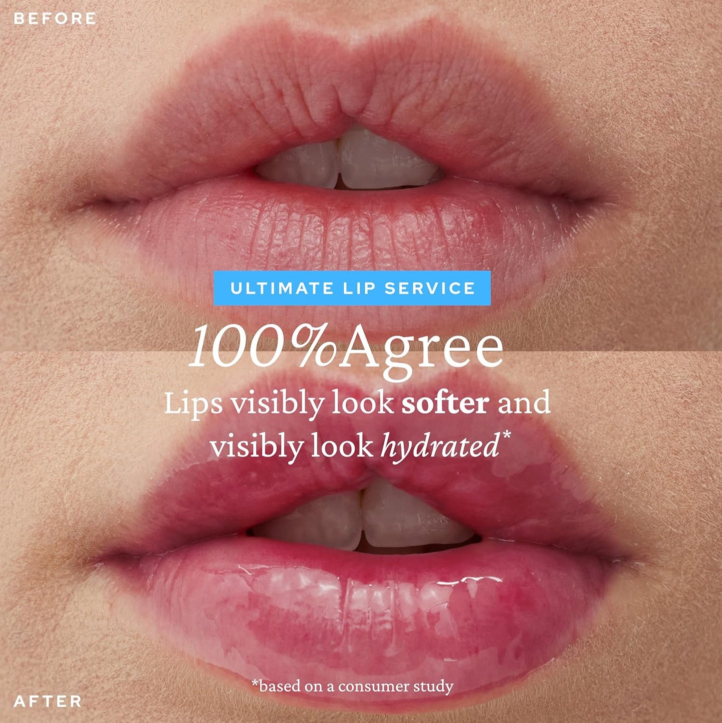 Before and after comparison of lips with text overlay on a beige background