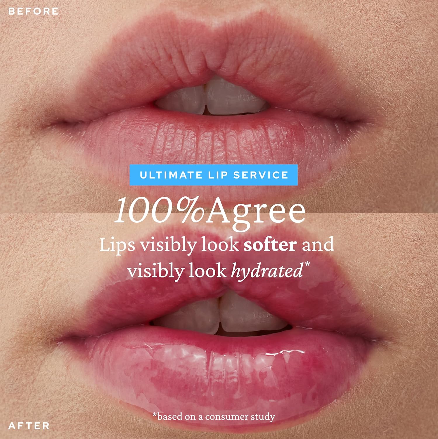 Before and after comparison of lips with text overlay on a beige background