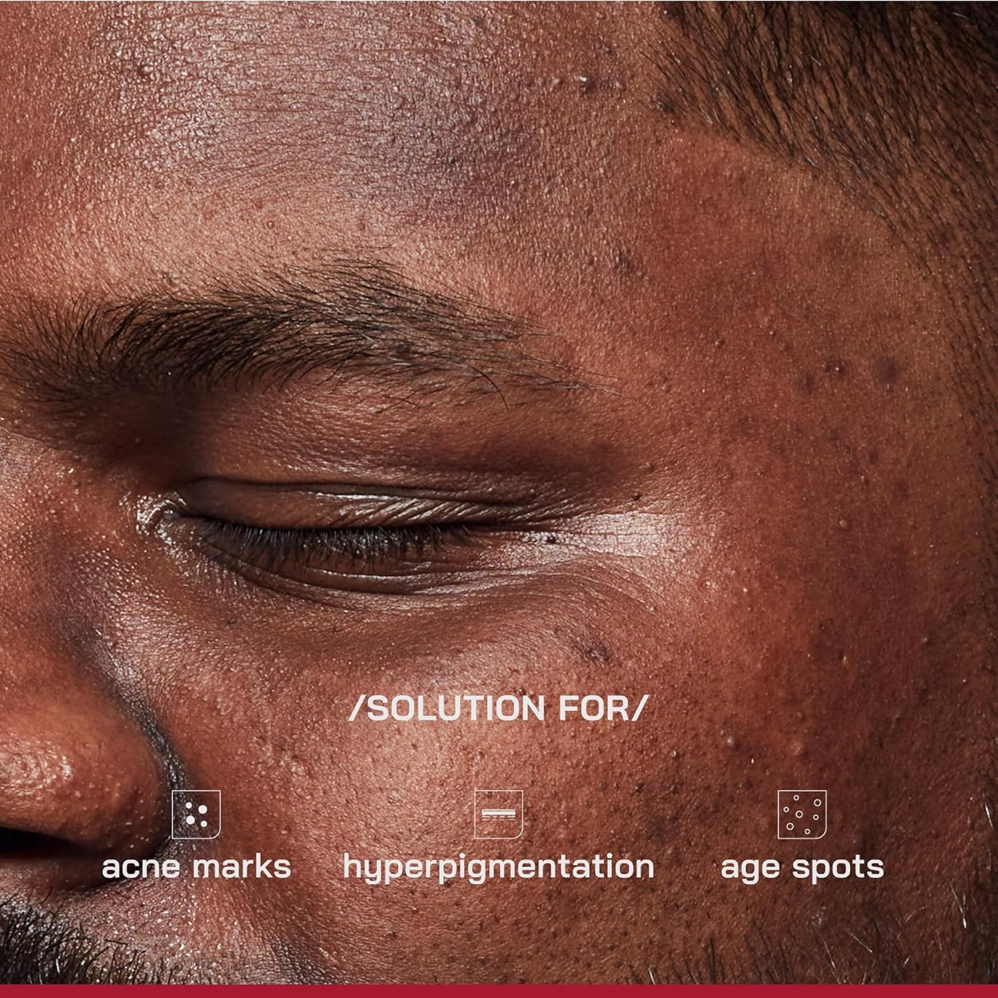 /PHD/ 2% Alpha Arbutin Depigmentation Serum | Alpha Arbutin for Pigmentation & Dark Spot | Pigmentation serum for Women & Men | Tyrobright™, Niacinamide | Tan removal | Fragrance-Free | 10ml